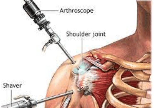 hip arthroscopy near me