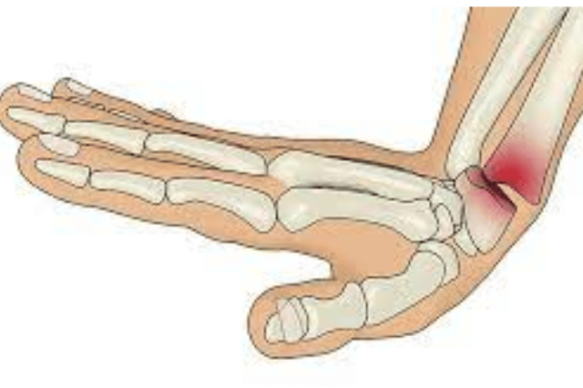 orthopaedic doctor in wakad