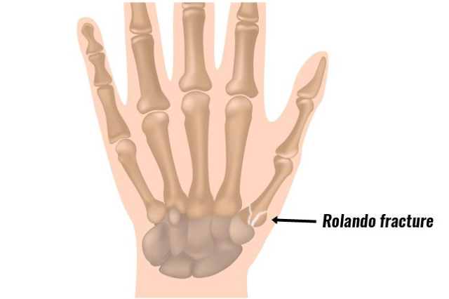 best orthopaedic surgeon in pune