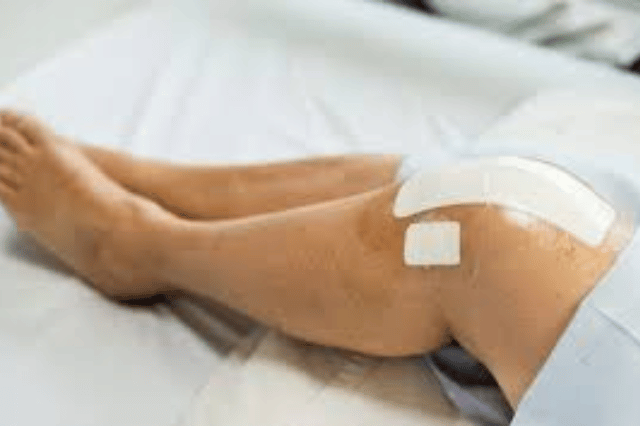 joint replacement doctor