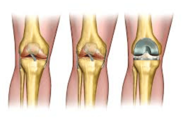 knee orthopedic surgeon