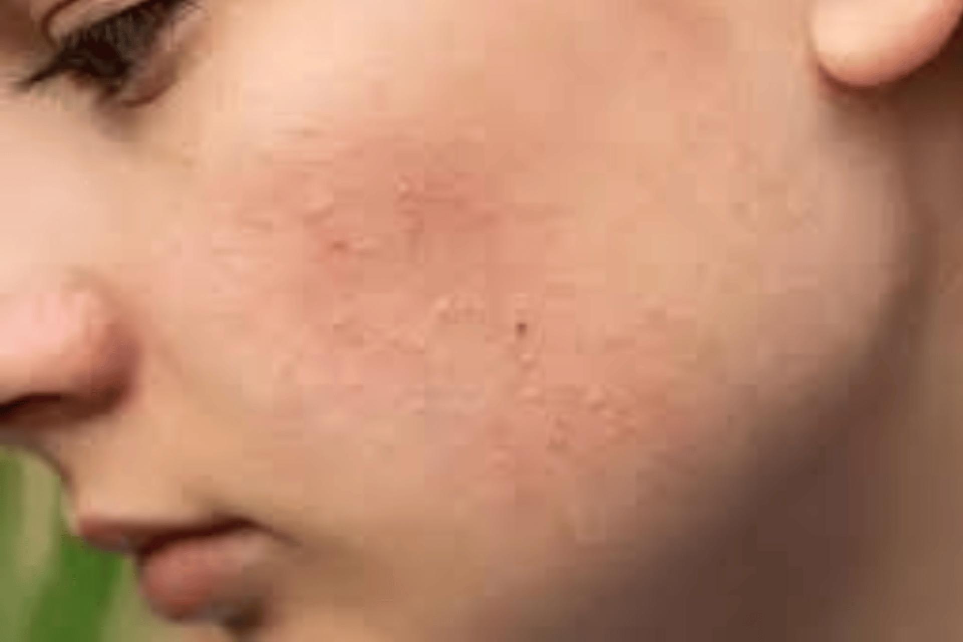 big toe callus removal