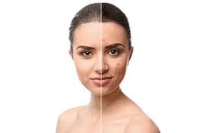 medicine for skin disease