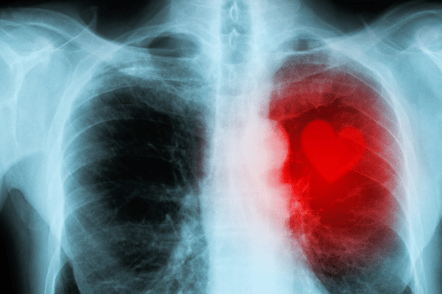 cardiovascular hospital