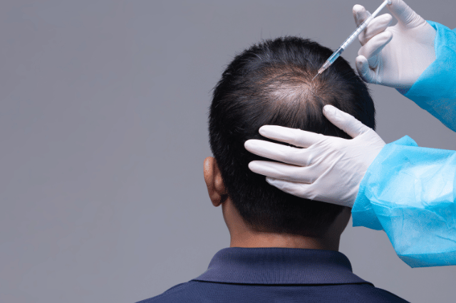 hair fall specialist in pune