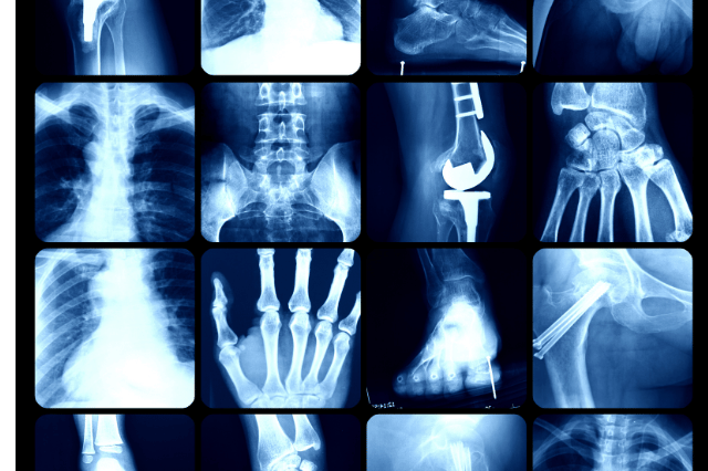 opg x ray cost in pune
